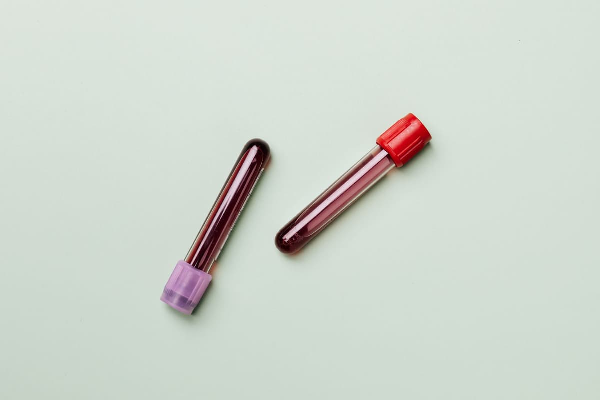 ApoB and Modern Lipid Testing: Why LDL Isn't the Whole Story