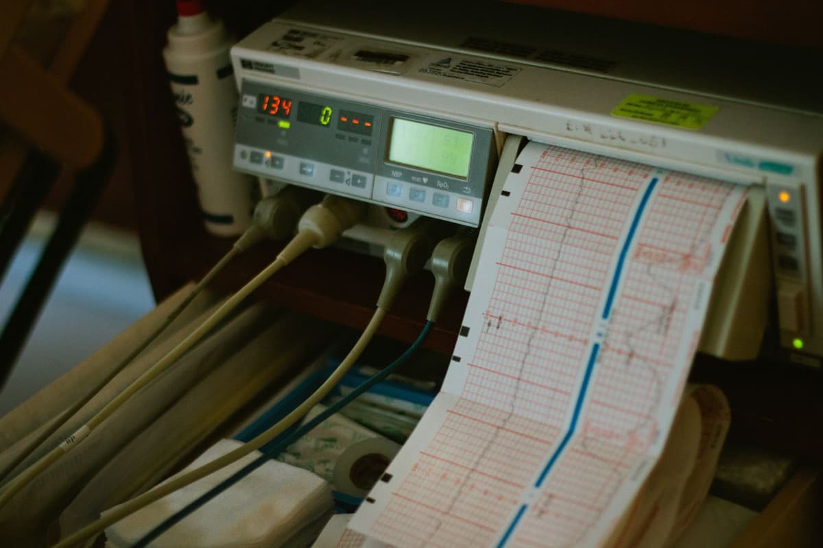 Heart Palpitations: When to Worry and What Tests You Need