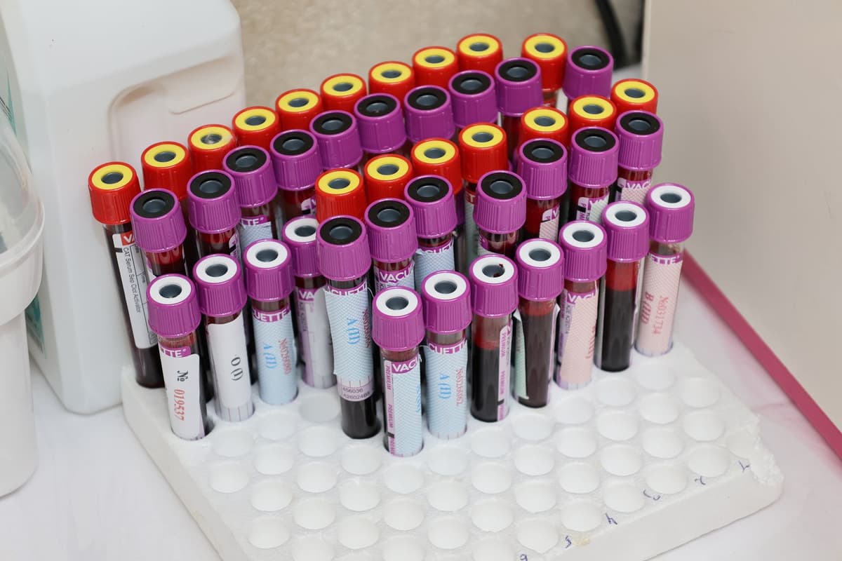 Hepatitis C: The One-Time Screening Every Adult 18-79 Should Get
