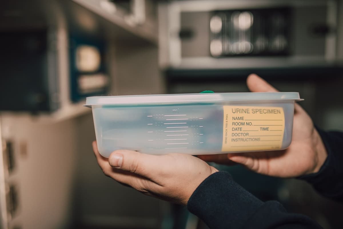 Microscopic Hematuria: What Blood in Your Urine Tests Might Mean