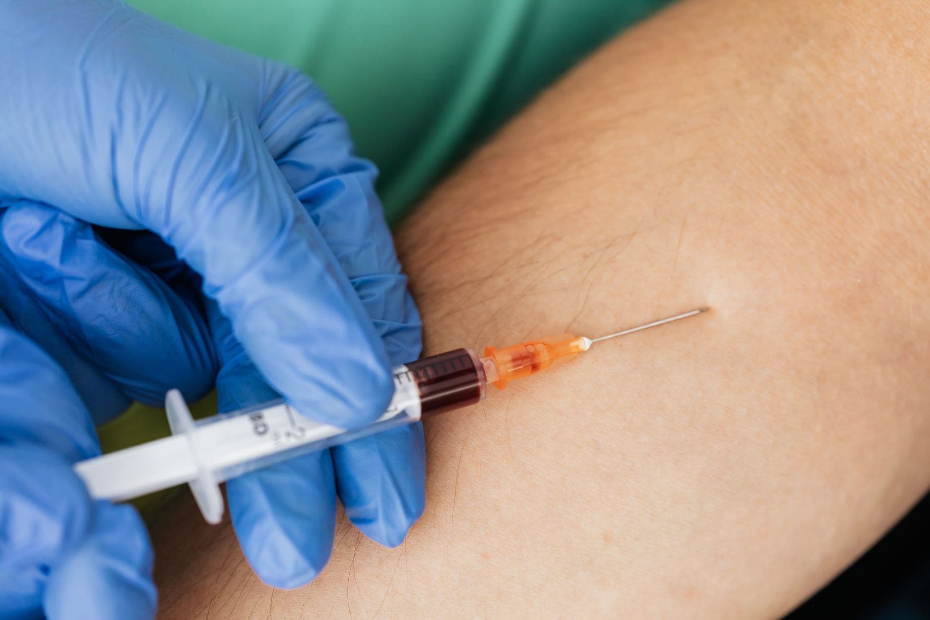 Chronic Hives: When Itching Lasts More Than Six Weeks